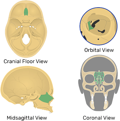 Ethmoid