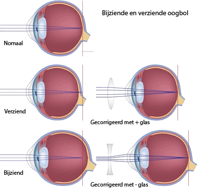 De lengte van de oogbol